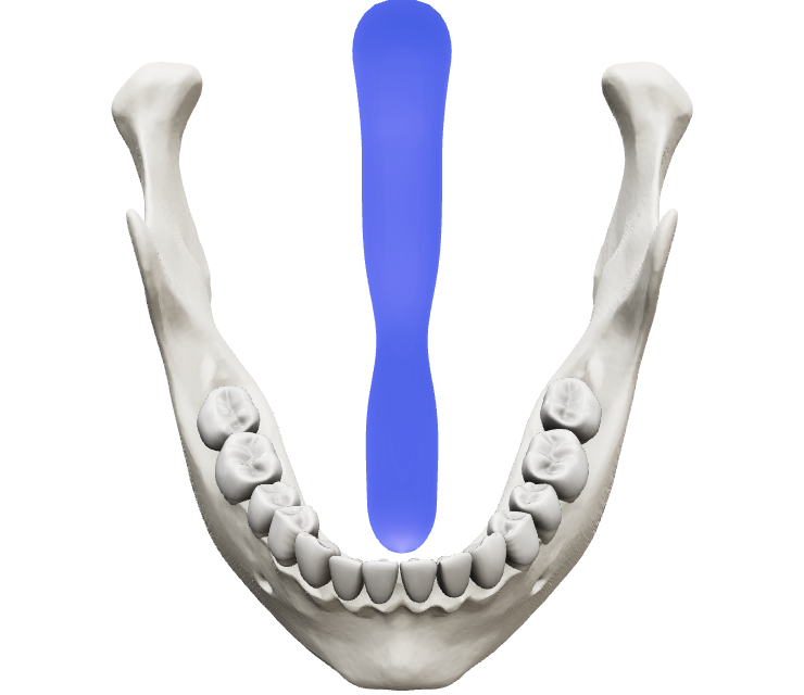 Three dimensional model of a human mandible with its teeth, seen from the front and above, with the airway behind the tongue in blue.